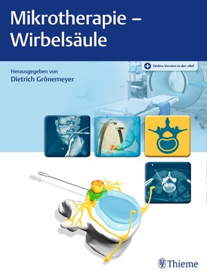 cover image of Mikrotherapie--Wirbelsäule